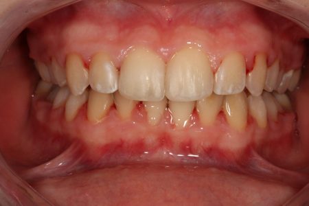 Aparat_Fix_5721
