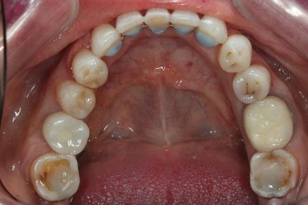 Aparat_Fix_6145