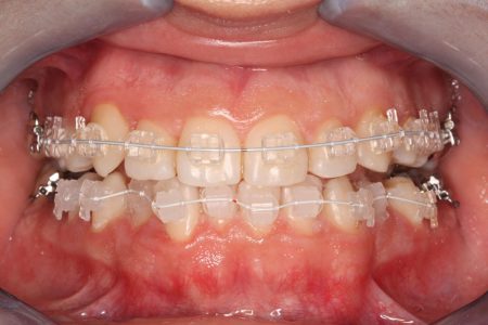 Aparat_fix_6932
