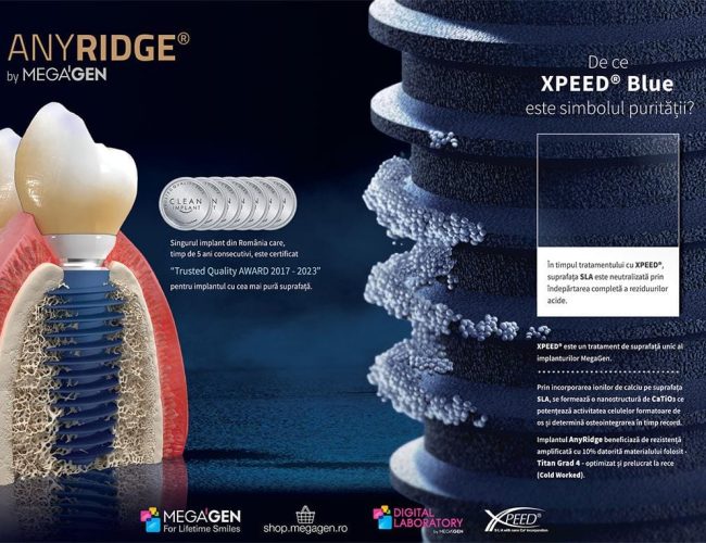 Poster anyridge